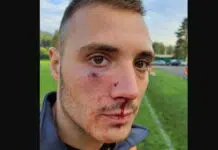 (FOTO) STRAVA I UŽAS: Navijači Budućnosti nakon utakmice teško pretukli fudbalera Stupčanice Strava I Uzas Navijaci Buducnosti Nakon Utakmice Tesko Pretukli